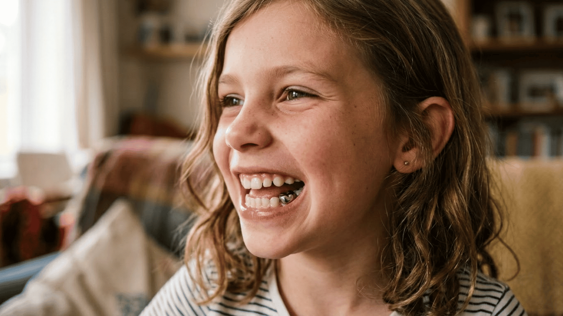 why-do-kids-get-silver-tooth